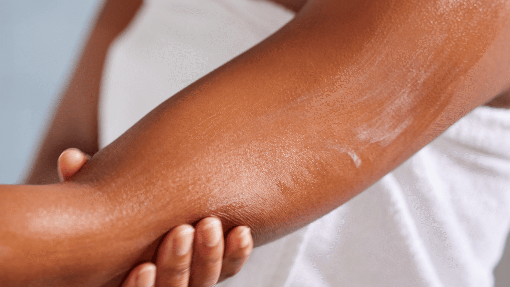 Mujer poniendose crema hidratante en el brazo