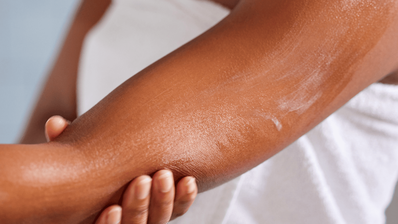 Mujer poniendose crema hidratante en el brazo